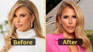 tracy tudor|tracy tudor plastic surgery.